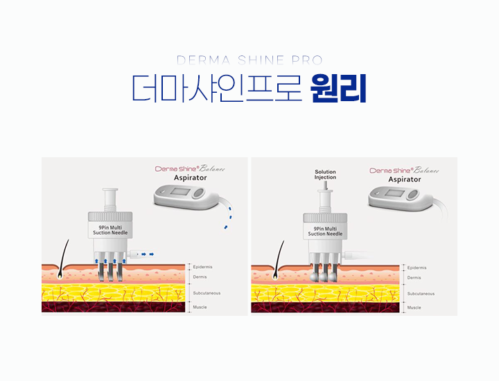 진피부비뇨기과 피부클리닉 더마샤인프로